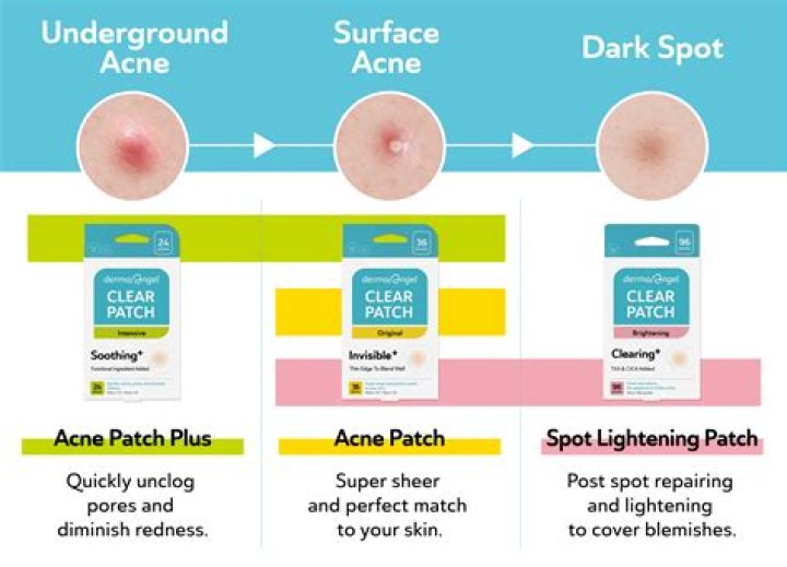 acne patch