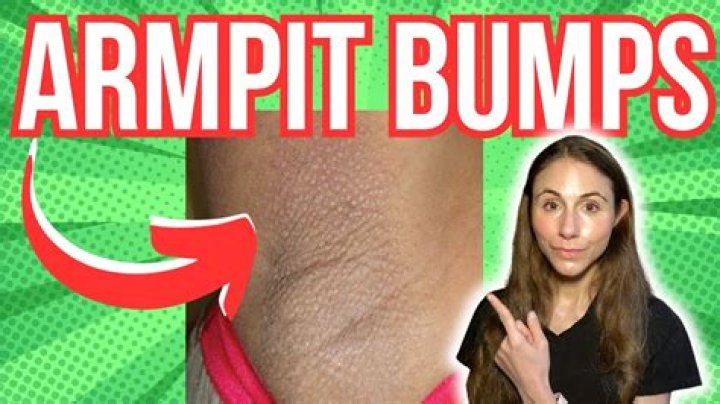armpit zit