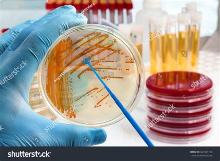 bacterial culture
