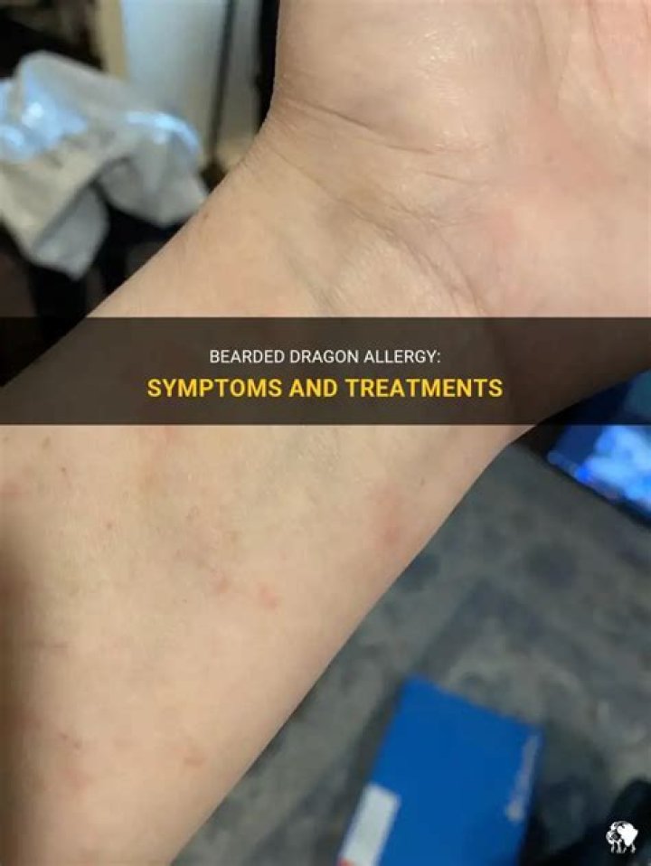 Bearded Dragon Allergy Bearded Dragon Allergy