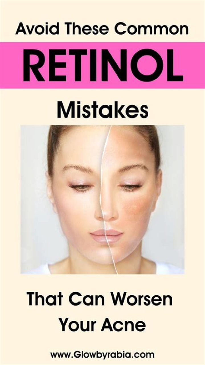 best retinol for acne