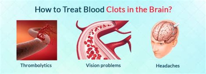 blood clot in brain symptoms