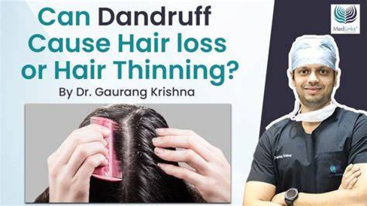 can dandruff cause hair loss
