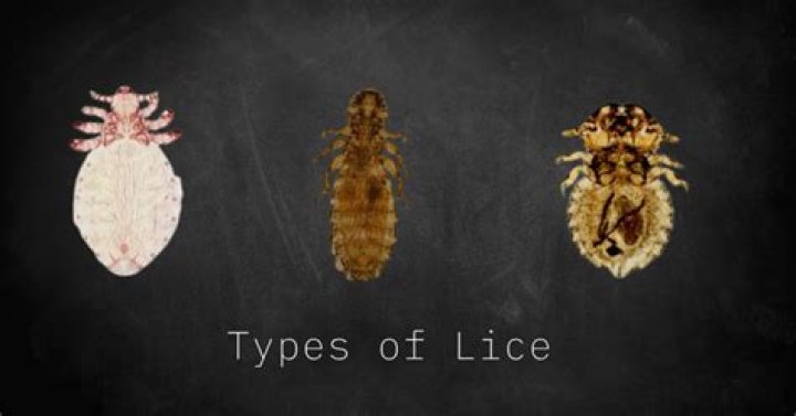 Can dogs get Lice