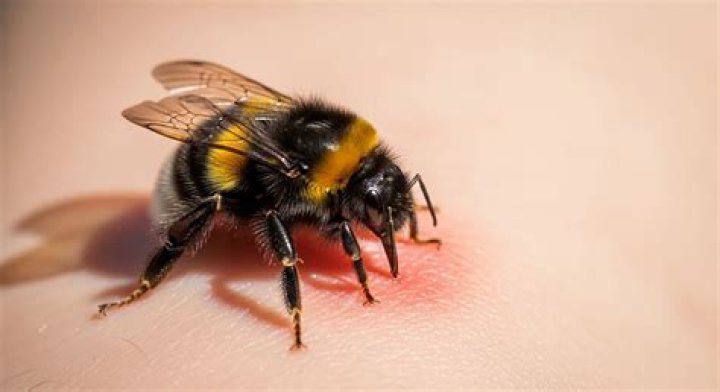 Do bumblebee sting