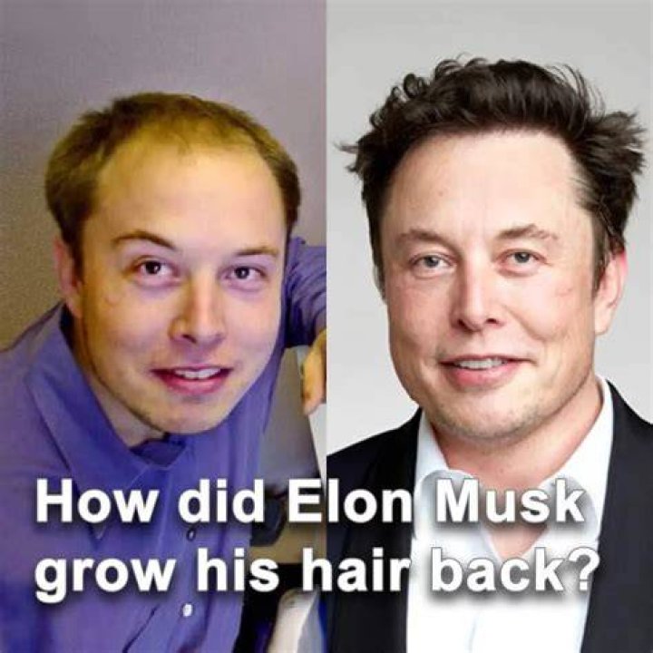 Elon Musk hair