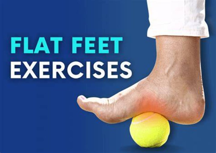 Flat feet Therapy