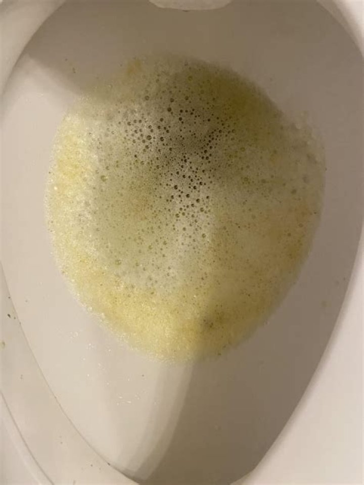 foamy diarrhea