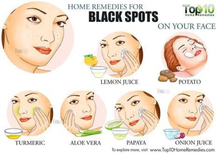 get rid of dark spots