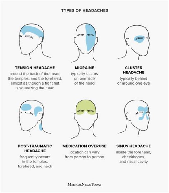 headache