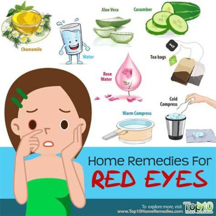 home remedies for red eyes