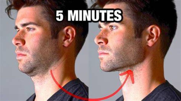 how to improve jawline