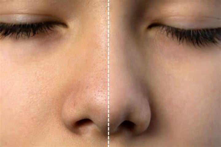 how to shrink pores