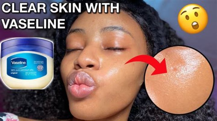 is vaseline good for face