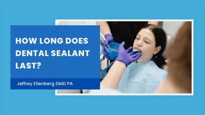 Question: How Long Does Tire Sealant Last