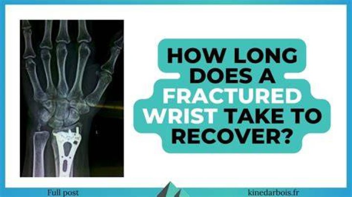 Question: How Long Off Work With Broken Wrist