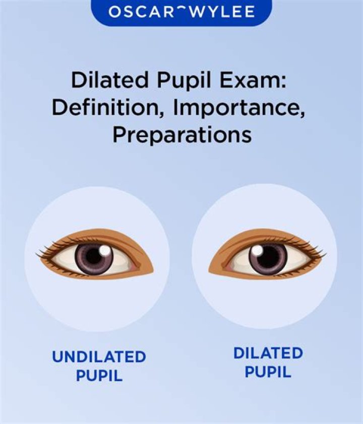 Quick Answer: What Do Dilated Pupils Look Like In Dogs