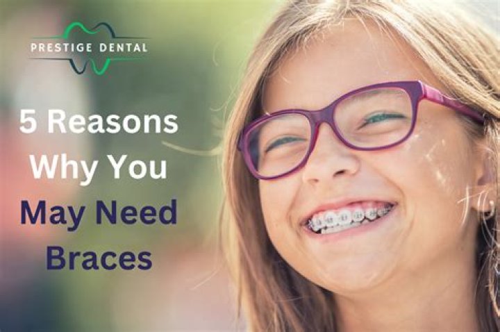 Reasons Why You May Need A Car Accident Lawyer Syracuse Reasons Why You May Need A Car Accident Lawyer Syracuse