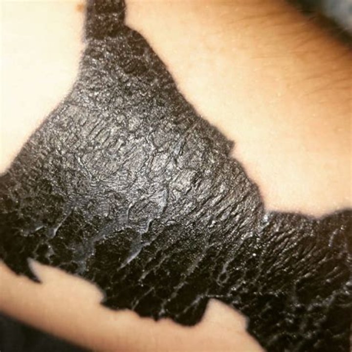 tattoo cracking
