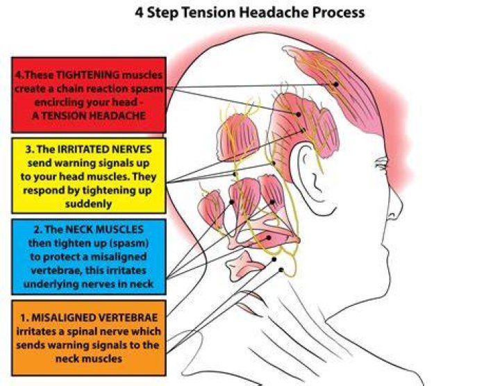 tension headache