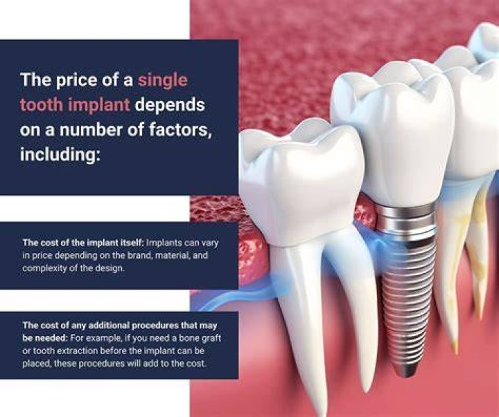 tooth implant cost