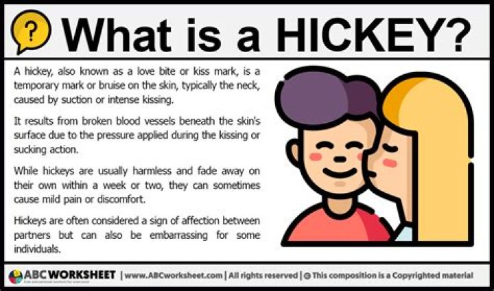 What Does A Hickey Look Like What Does A Hickey Look Like