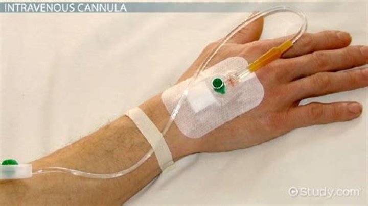 what is a cannula
